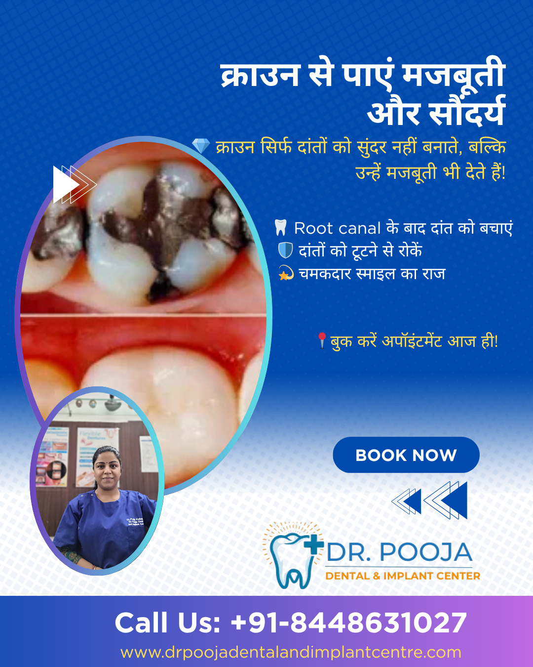 Crown & Bridges in Dwarka Sector 8 - 3